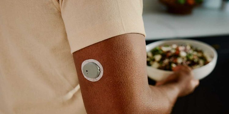 Dexcom Stelo: A New Weapon in the Fight against Type 2 Diabetes