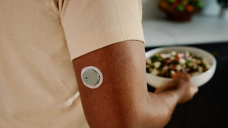 Dexcom Stelo: A New Weapon in the Fight against Type 2 Diabetes